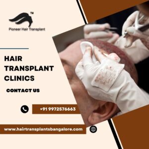 Hair Transplant Clinics in Bangalore 300x300