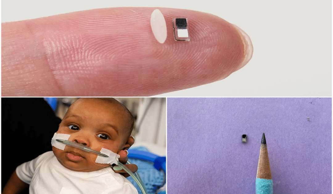 Tiny Guardian: Revolutionary Pacemaker Offers Hope for Newborns with Heart Defects