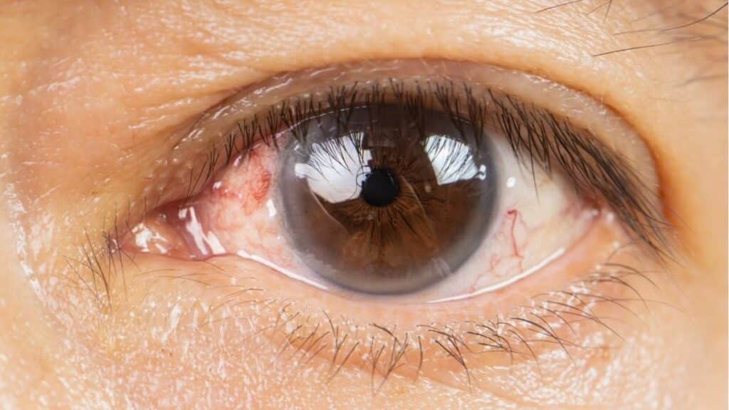 Eye Health Tips Indian Children & Screen Time Abroad (3)