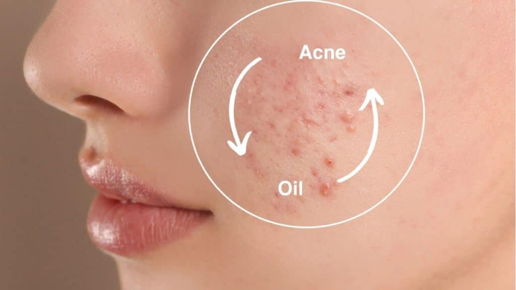 How to Protect Your Skin While Wearing Makeup Every Day 3 Oily Skin